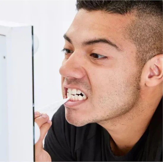 Smileé™ – Stylo Blanchissant Dentaire